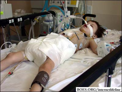 Without Arife's surgery, Dr. Crooke does not believe she would survive for even one more month