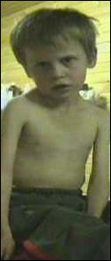 Arife Zejna in hard need for a lifesaving surgery